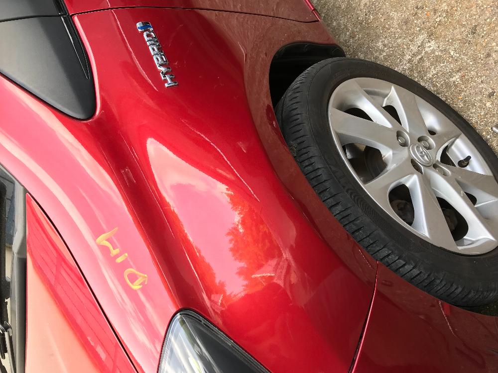 Medium paintless dent removal
